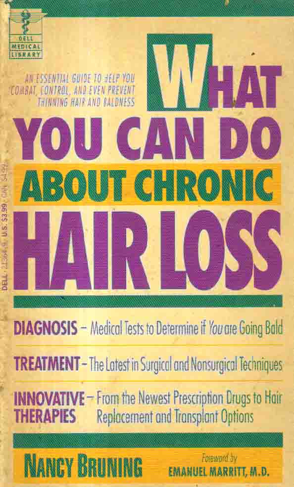 What you can do about chronic hair loss.
