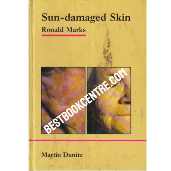 Sun Damaged Skin 1st edition